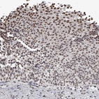 Immunohistochemical staining of human urinary bladder shows strong nuclear positivity in urothelial cells.