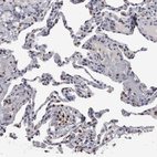 Immunohistochemical staining of human lung shows moderate nuclear positivity in subset of macrophages.