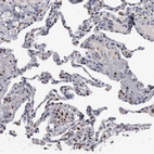 Immunohistochemical staining of human lung shows moderate nuclear positivity in subset of macrophages.