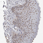 Immunohistochemical staining of human skin shows moderate nuclear positivity in squamous epithelial cells.