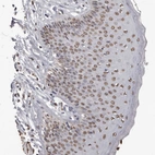 Immunohistochemical staining of human skin shows moderate nuclear positivity in squamous epithelial cells.