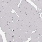 Immunohistochemical staining of human skeletal muscle shows no positivity in myocytes as expected.