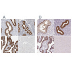Immunohistochemical staining of human cervix, uterine, endometrium, fallopian tube and skeletal muscle using Anti-ASRGL1 antibody HPA029725 (A) shows similar protein distribution across tissues to independent antibody HPA055572 (B).