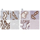 Immunohistochemical staining of human cervix, uterine, endometrium, fallopian tube and skeletal muscle using Anti-ASRGL1 antibody HPA029725 (A) shows similar protein distribution across tissues to independent antibody HPA055572 (B).