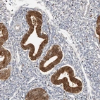 Immunohistochemical staining of human endometrium shows moderate to strong cytoplasmic positivity in glandular cells.