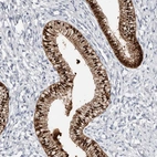 Immunohistochemical staining of human cervix, uterine shows moderate to strong cytoplasmic positivity in glandular cells.