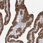 Anti-ASRGL1 Antibody