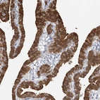 Immunohistochemical staining of human fallopian tube shows moderate to strong cytoplasmic positivity in glandular cells.