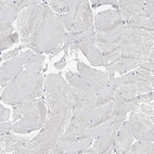 Immunohistochemical staining of human skeletal muscle shows no positivity in myocytes as expected.