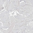 Immunohistochemical staining of human skeletal muscle shows no positivity in myocytes as expected.