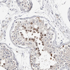 Anti-ASRGL1 Antibody