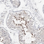 Immunohistochemical staining of human testis shows moderate positivity in a subset cells in seminiferous ducts.
