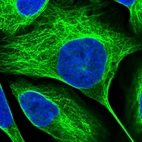 Immunofluorescent staining of human cell line U-2 OS shows localization to nucleoplasm & microtubules.