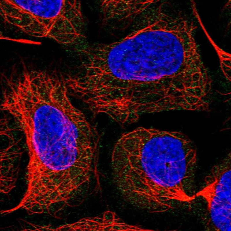 Anti-HBS1L Antibody