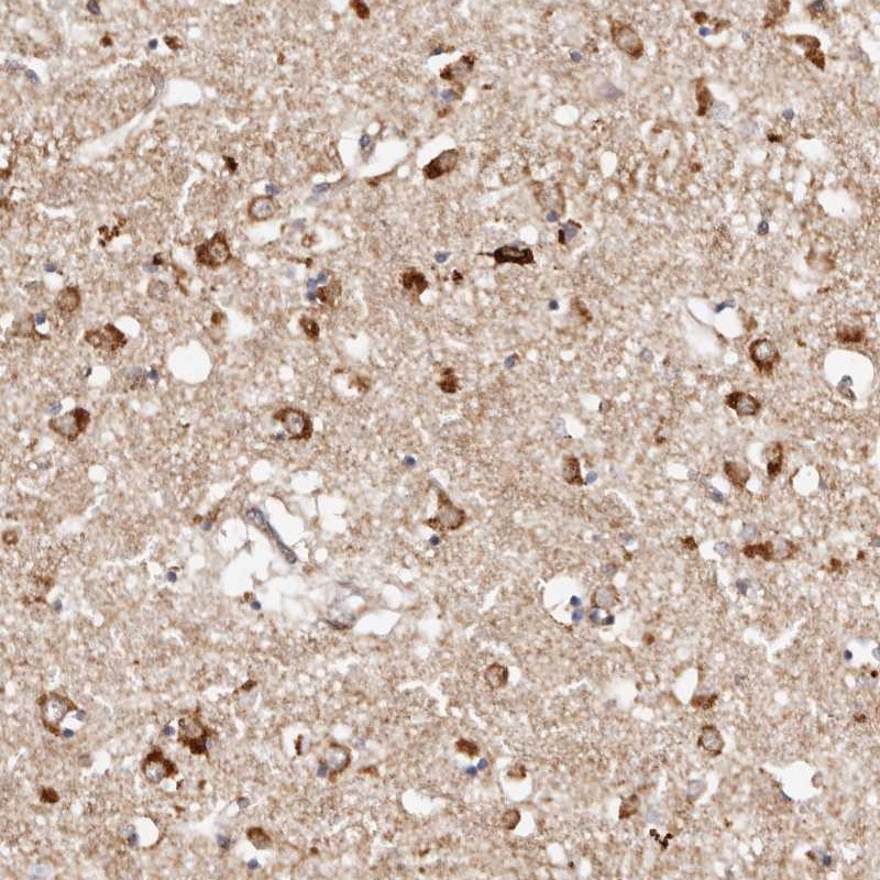 Anti-BCL2L15 Antibody