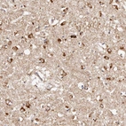 Anti-BCL2L15 Antibody