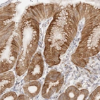 Immunohistochemical staining of human stomach shows moderate cytoplasmic positivity in glandular cells.
