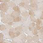 Immunohistochemical staining of human skeletal muscle shows very weak cytoplasmic positivity in myocytes.