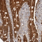 Immunohistochemical staining of human duodenum shows strong cytoplasmic positivity in glandular cells.