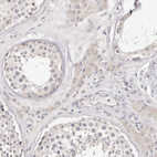 Immunohistochemical staining of human testis shows no positivity in cells in seminiferous ducts as expected.