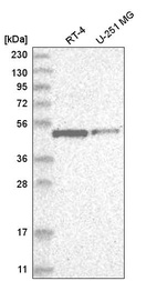 Anti-E2F1 Antibody