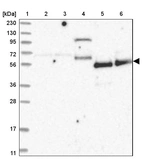 Lane 1: Marker [kDa] 230, 130, 95, 72, 56, 36, 28, 17, 11_br/_Lane 2: Human cell line RT-4_br/_Lane 3: Human cell line U-251MG sp_br/_Lane 4: Human plasma (IgG/HSA depleted)_br/_Lane 5: Human liver tissue_br/_Lane 6: Human tonsil tissue