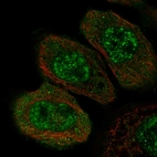 Immunofluorescent staining of human cell line A-431 shows localization to nuclear speckles & cytosol.