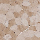 Immunohistochemical staining of human skeletal muscle shows moderate cytoplasmic positivity in myocytes.