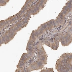 Immunohistochemical staining of human Fallopian tube shows moderate membranous and cytoplasmic positivity in glandular cells.