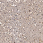 Immunohistochemical staining of human liver shows weak to moderate cytoplasmic positivity in hepatocytes.