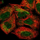 Immunofluorescent staining of human cell line A549 shows localization to cytosol & vesicles.