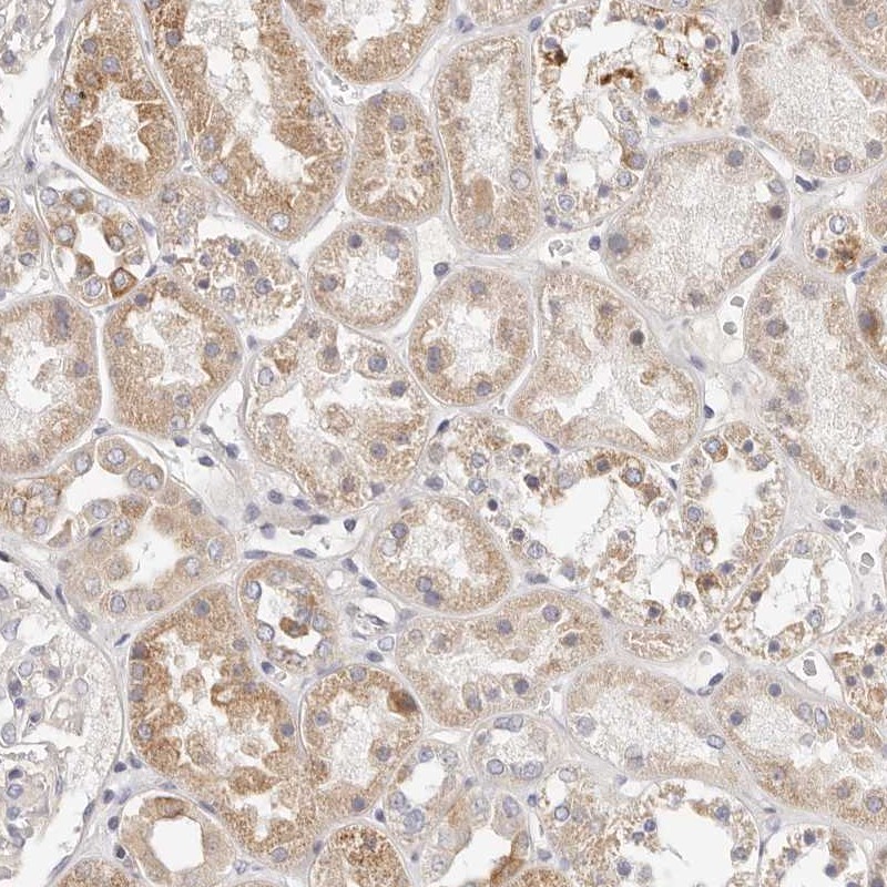 Anti-MYOM3 Antibody