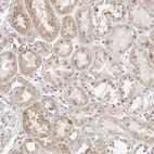Anti-MYOM3 Antibody