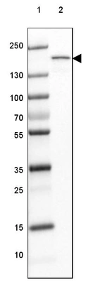 Lane 1: Marker [kDa] 250, 130, 100, 70, 55, 35, 25, 15, 10_br/_Lane 2: Human Skeletal muscle tissue