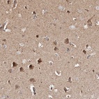 Anti-PRKACB Antibody