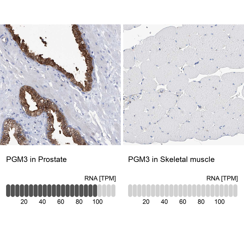 Anti-PGM3 Antibody