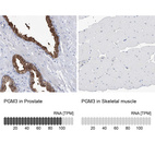 Anti-PGM3 Antibody