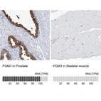 Anti-PGM3 Antibody