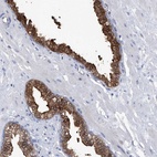Immunohistochemical staining of human prostate shows high expression.