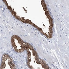 Immunohistochemical staining of human prostate shows high expression.