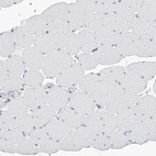 Immunohistochemical staining of human skeletal muscle shows low expression as expected.
