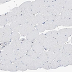Immunohistochemical staining of human skeletal muscle shows low expression as expected.
