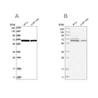 Western blot analysis using Anti-PGM3 antibody HPA029759 (A) shows similar pattern to independent antibody HPA029760 (B).