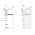 Western blot analysis using Anti-PGM3 antibody HPA029759 (A) shows similar pattern to independent antibody HPA029760 (B).