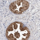 Anti-PGM3 Antibody