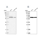 Western blot analysis using Anti-PGM3 antibody HPA029760 (A) shows similar pattern to independent antibody HPA029759 (B).