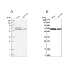 Western blot analysis using Anti-PGM3 antibody HPA029760 (A) shows similar pattern to independent antibody HPA029759 (B).