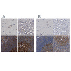 Anti-CDV3 Antibody