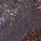 Immunohistochemical staining of human lymph node using Anti-CDV3 antibody HPA029761.