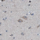 Immunohistochemical staining of human cerebral cortex using Anti-CDV3 antibody HPA029761.